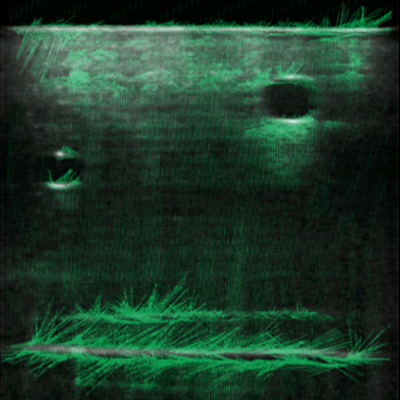 Implicit 3D Functions for Ultrasound